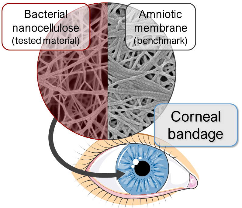 corneal bandage toc