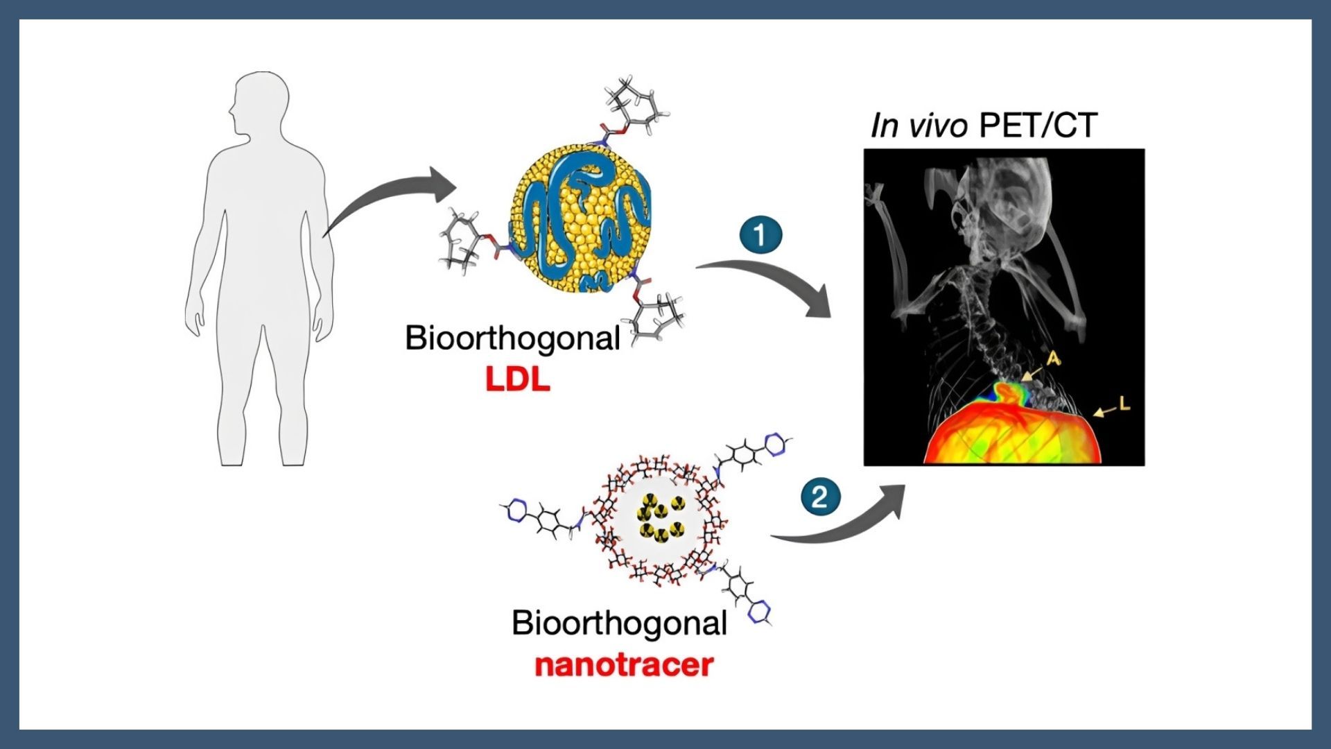Targeted PET Imaging of Atherosclerosis via Low-Density Lipoprotein Click Chemistry with Nanoparticles