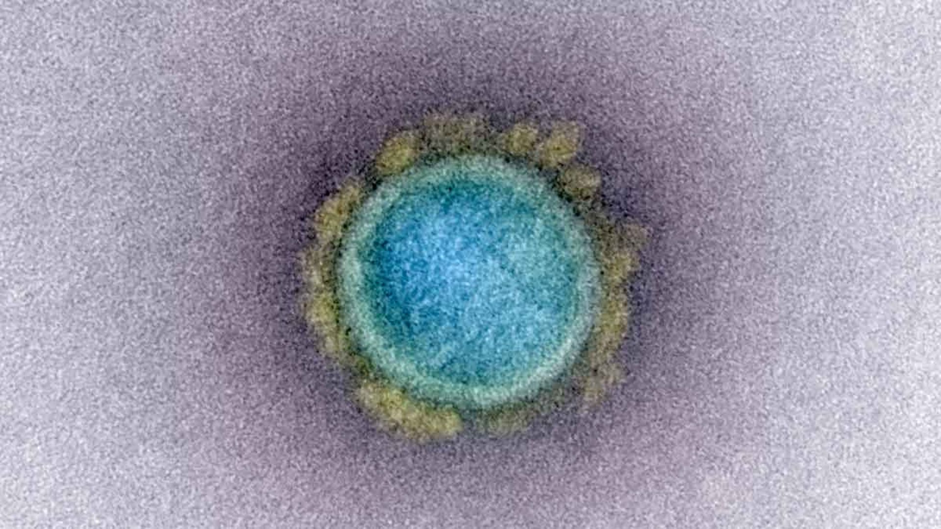 Image: Electron microscopy image of a typical SARS-CoV-2 coronavirus particle, freely distributed by the NIAID’s Rocky Mountain Laboratories (NIAID-RML),1 colored to emphasize the virus structure.