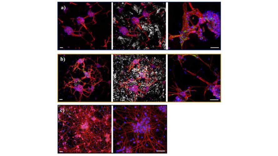 3D Reduced Graphene Oxide Scaffolds with a Combinatorial Fibrous-Porous Architecture for Neural Tissue Engineering