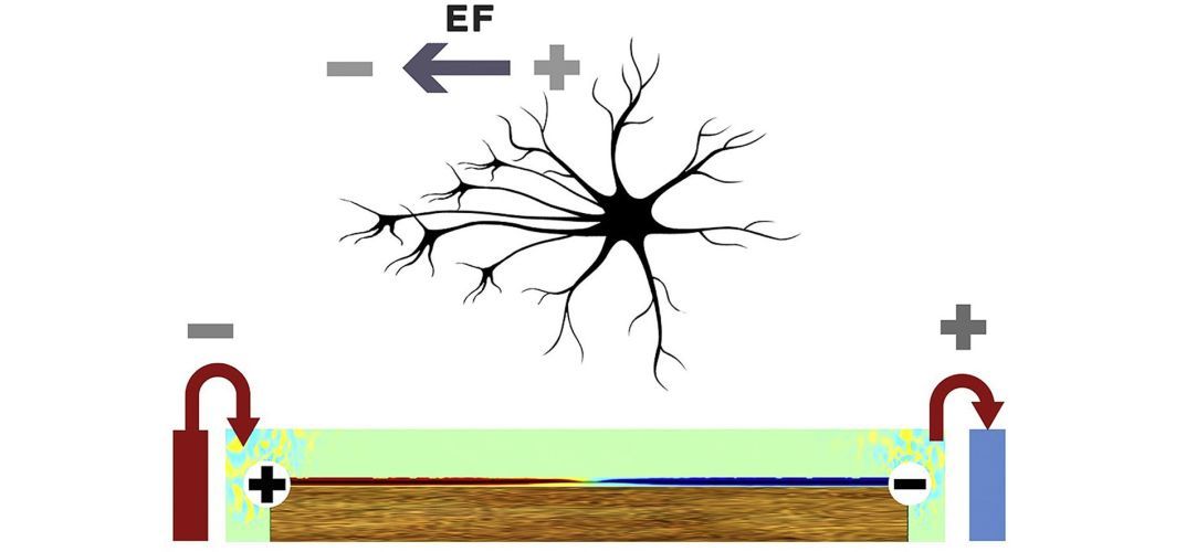 Electric field gradients and bipolar electrochemistry effects on neural growth: A finite element study on immersed electroactive conducting electrode materials