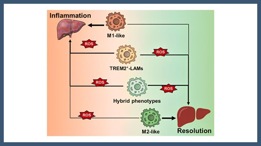 Beyond M1/M2: The role of reactive oxygen species in liver fibrosis and immune modulation
