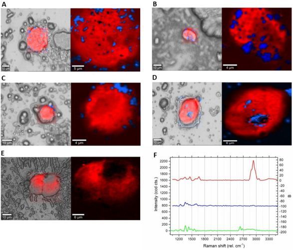 A Potential Boron Neutron Capture Therapy Agent Selectively Suppresses High-Grade Glioma: In Vitro and in Vivo Exploration