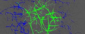 Difference TIRF micrograph showing the areas with depleted and enriched traveller molecules. Image Credit: SLIM Service/University of Nottingham